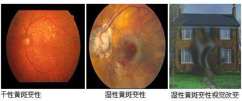 聚焦快读 第430页