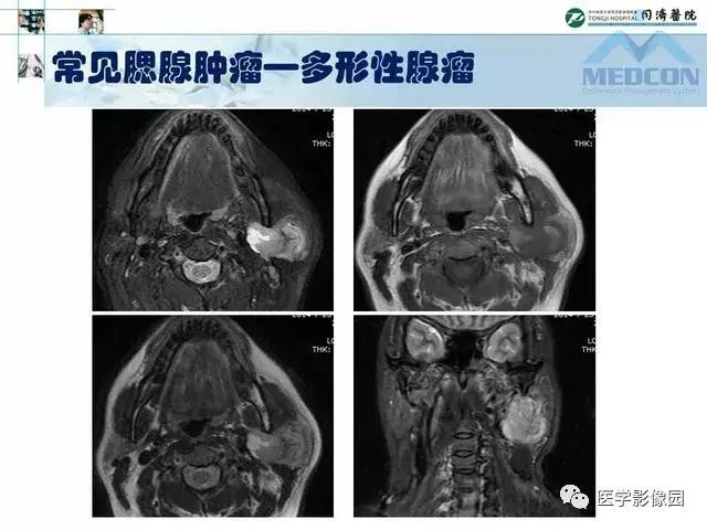 专题快报 第405页